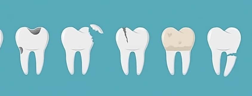 Cavity Pain Graphic