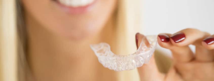 Todays Dental Invisalign Worth Cost