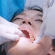 Dentist Examines The Patient Teeth