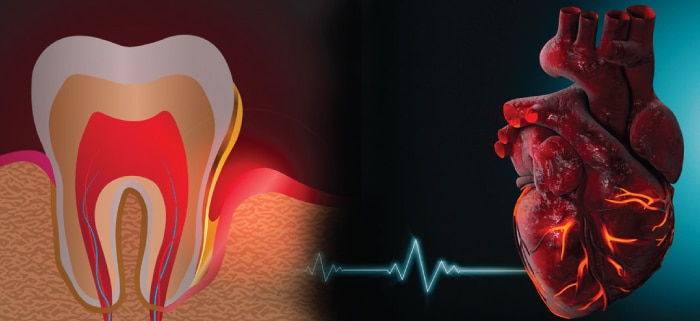 Heart Health Oral Health Connection