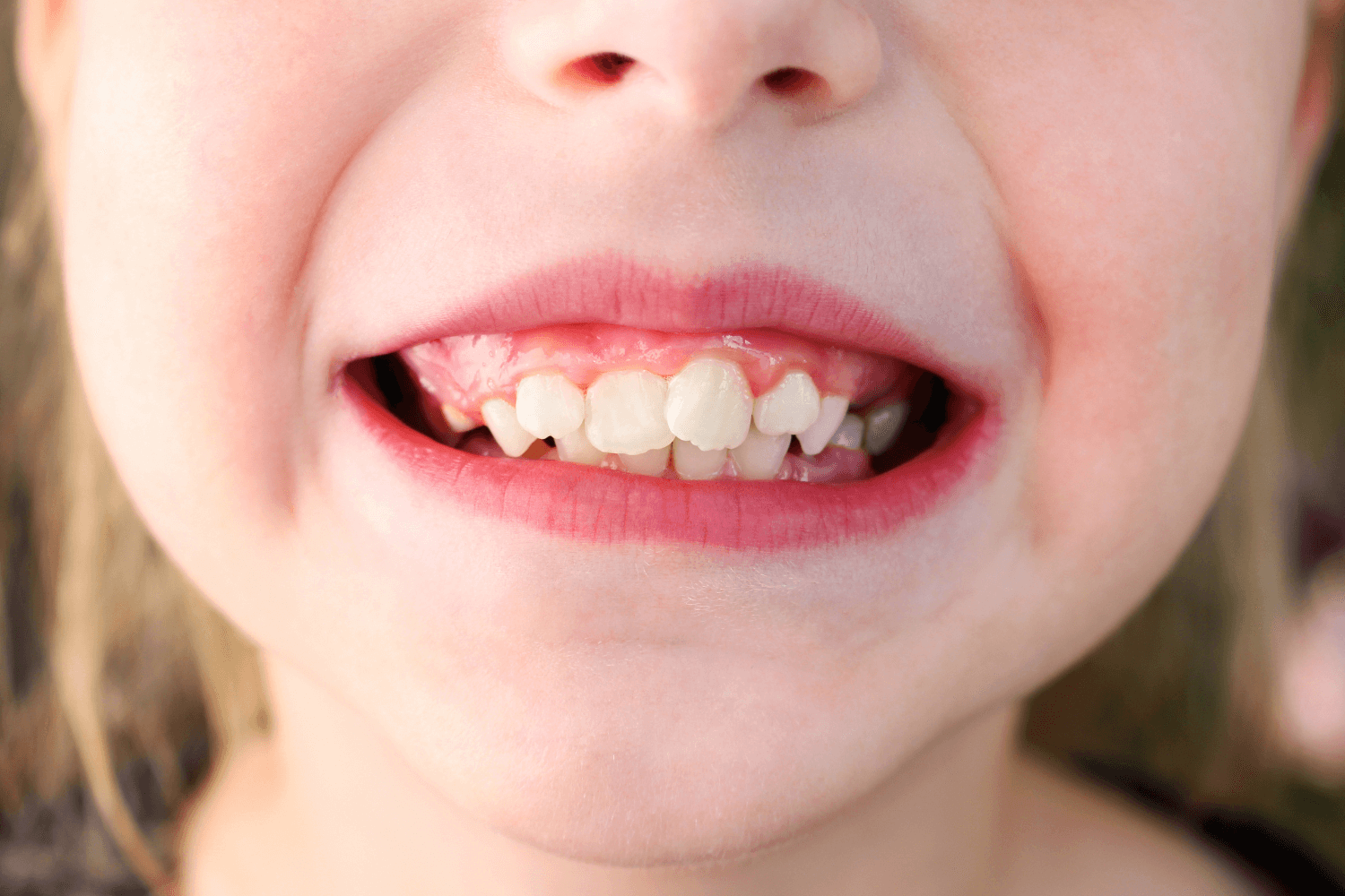 Child Showing Off Their Teeth