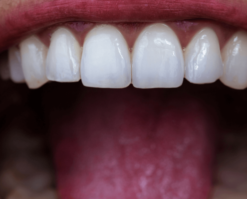 Close Up Of Healthy Canine Teeth