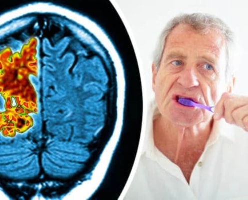 Man With Alzheimer’s Disease Brushing Teeth