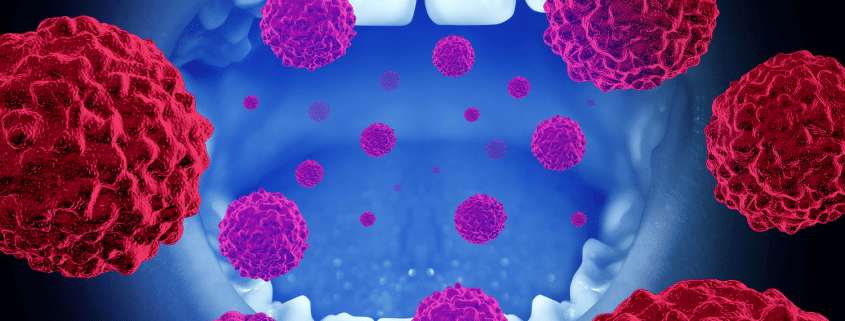 An Illustration Highlighting Common Types Of Oral Infections.