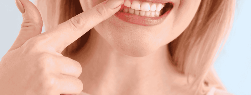 Manage Stress And Bleeding Gums