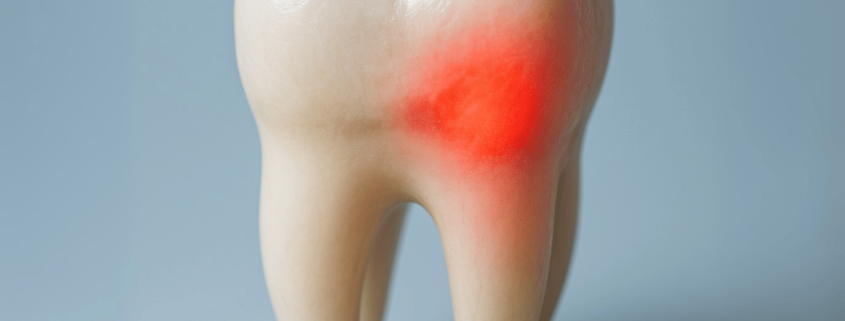 Thinning Tooth Enamel Causes, Symptoms, And Effective Treatments