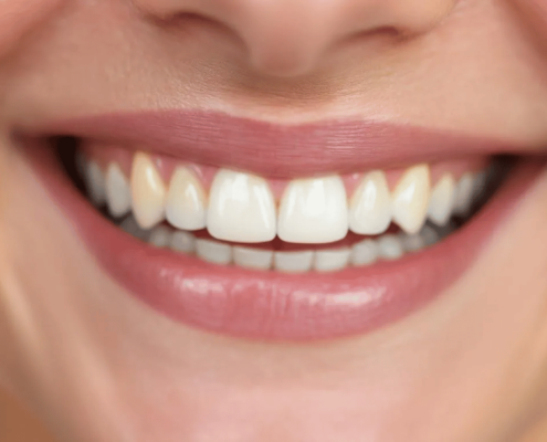 A Close-Up Image Captures A Person'S Natural Smile, Highlighting The Slight Variations In Tooth Color, Which May Indicate Mild Tooth Discoloration Or Yellowing Teeth.